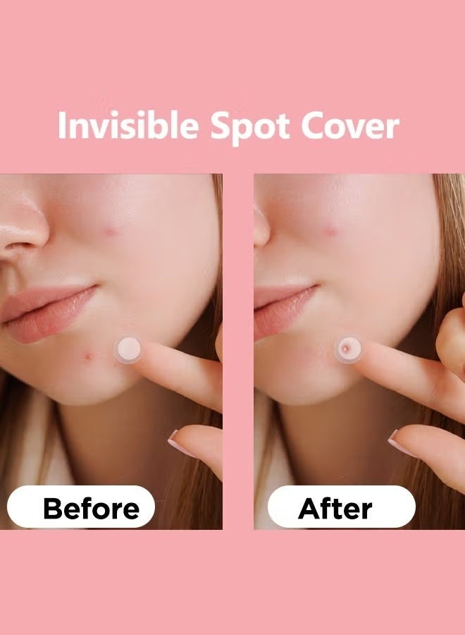Floren Amazing Acne Patches | 30 Patches, 2 Sizes (10mm, 15 Patches, 12mm) | Invisible Daytime Acne Coverage | Hydrocolloid Acne Patches | For Treating Pimples, Spots, and Rashes | South Korean Skincare | Drug-Free, Gentle on Skin, and Cruelty-Free - Image 2